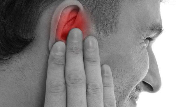 Otitis pirmais simptoms ir nieze auss kanālā