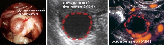 Dominant follicle. What is it, what size should it be by days of the cycle, ultrasound
