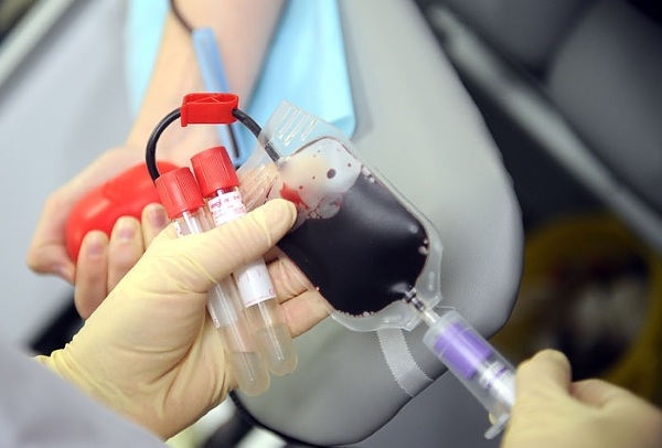 Biološki test za transfuziju krvi, njezine komponente. Što je to, kako se provodi