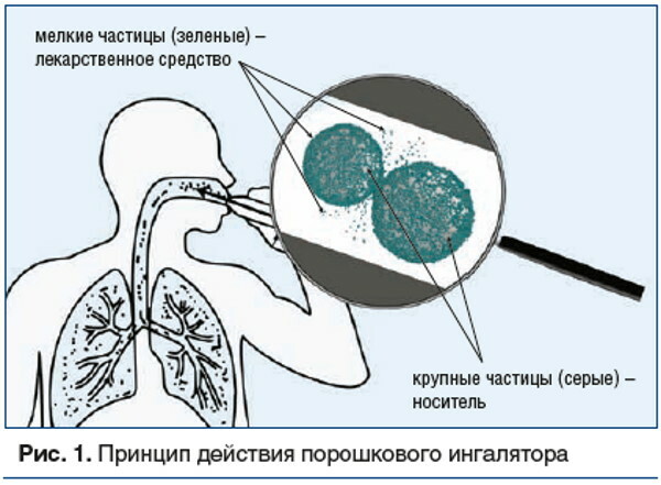 Fickinhalator för astmatiker. Applikationsalgoritm, regler