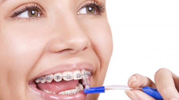 Børster for rengjøring av tenner. Hvordan velge, størrelser