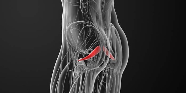 Inflammation of the piriformis muscle. Symptoms and treatment, exercise
