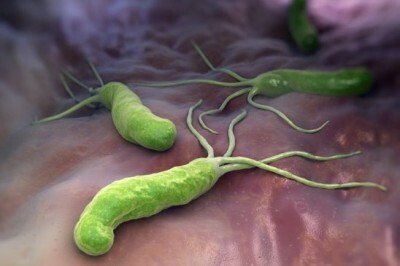 Helicobacter pylori Bakterium im Magen: Symptome, Behandlung