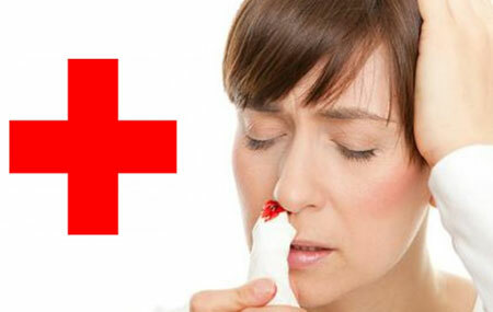 First aid for nasal bleeding