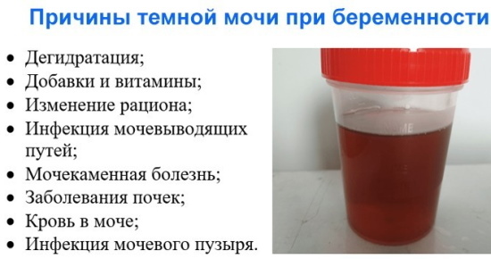 Brown urine in women. Causes for cystitis, pregnancy, menopause, treatment