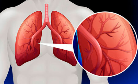Symptoms and degrees of pulmonary hypertension