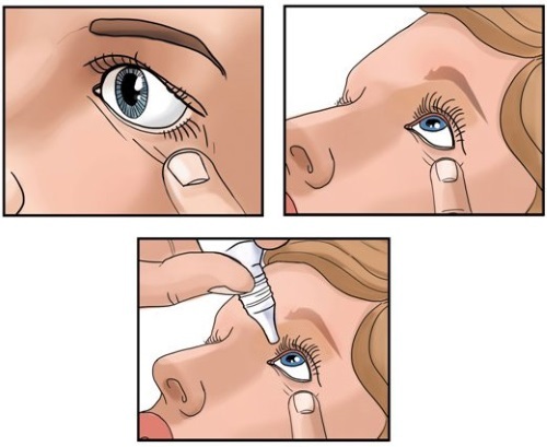 Riboflavin (Riboflavinum) eye drops. Instructions for use, price, reviews