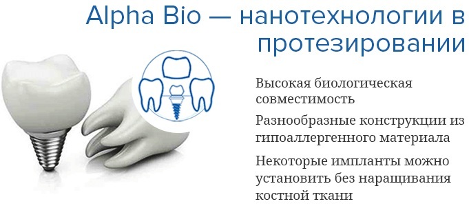 Implanturi Alpha Bio. Recenzii de pacienți, catalog, producători, de unde să cumpere, durata de viață, preț
