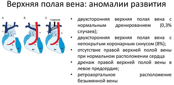Superior vena cava. Anatomi, topografi, dimensjoner, hvordan det dannes, hvilken sirkel av blodsirkulasjon, sideelver, skjema