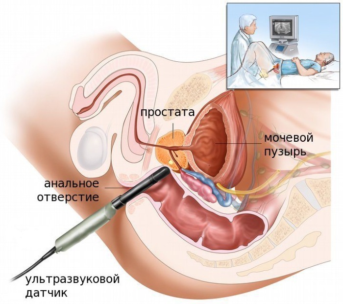 TRUZY. Preparation for the study of the prostate gland, bladder, interpretation of the results