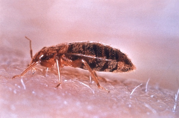 Bedbug bites on humans. Photos, symptoms, how to process, treat, what is fraught with