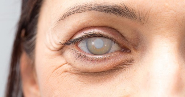 Drops with cataracts of the eye. List of the best after surgery, for prevention, vitamins