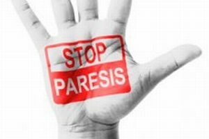 zaustaviti paresis