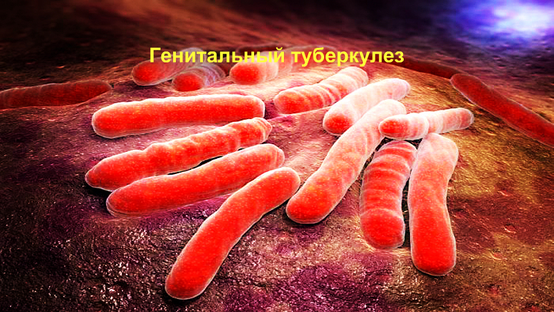 Tuberkulózis