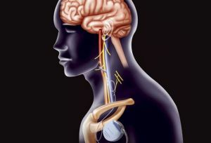 Stimulation of the vagus nerve