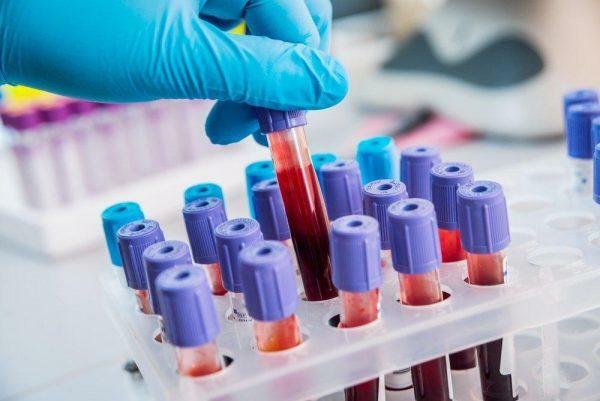 A kezelést csak az antitestek vérének vizsgálata után írják elő