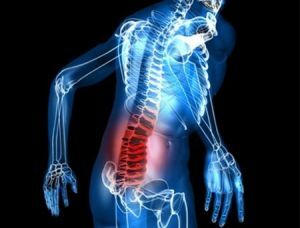 Tehlikeli olan vertebra retrolistezisidir: hastalık belirtileri ve tedavisi
