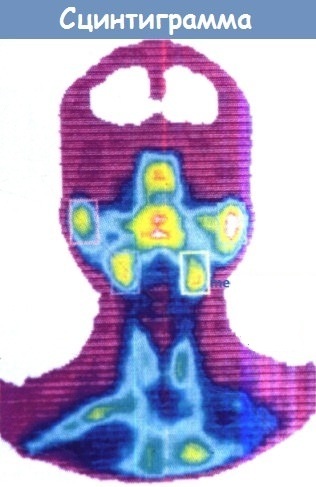 Parotid spytkirtel hos en person. Innervation, anatomi, histologi