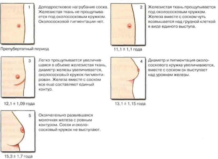 Why do women have small breasts? Causes
