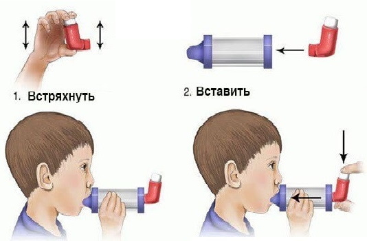 Inhalačné vložky pre deti. Ako použiť