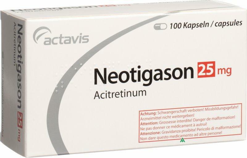 Neotigazone para el tratamiento de una forma complicada de psoriasis