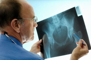Diagnose af osteoporose