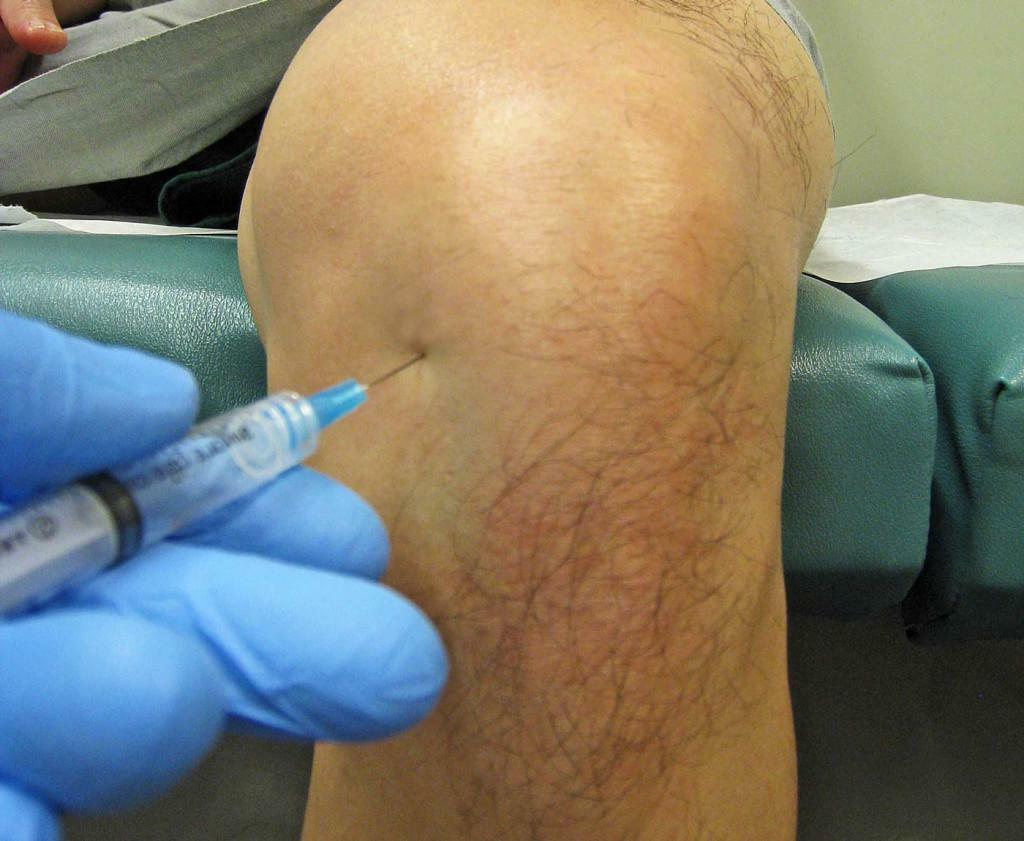 Injectarea în articulația genunchiului