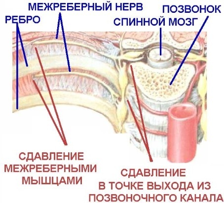 Berat di sebelah kiri di bawah tulang rusuk setelah makan di depan, samping, belakang