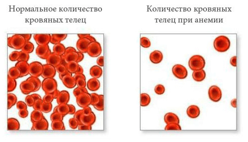 The number of blood cells in anemia