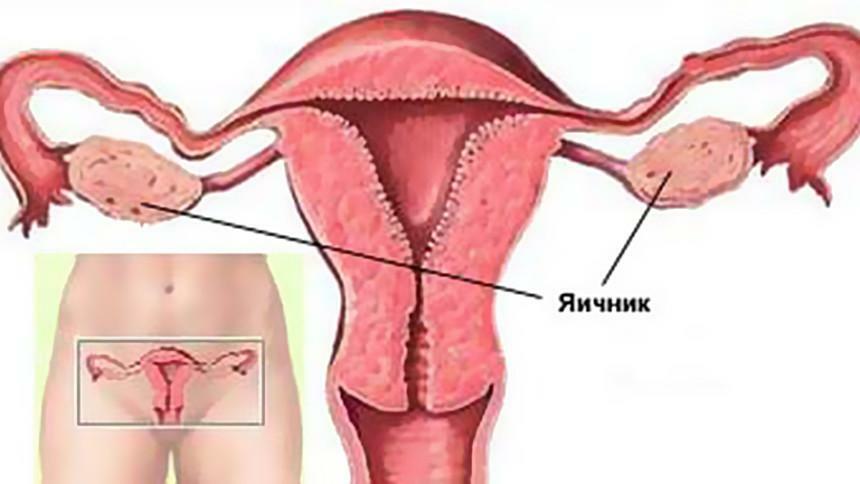 O trauma ovárico é uma das causas mais comuns de dor após a ovulação