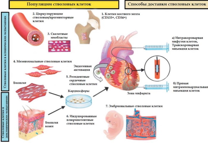 Cicatricialis változások a szívizomban az EKG -n