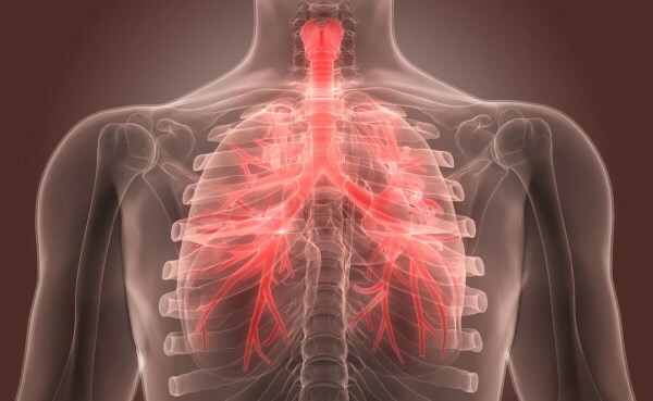 Znaki bronhitisa pri odraslih brez povišane telesne temperature s kašljem, izpljunkom in brez