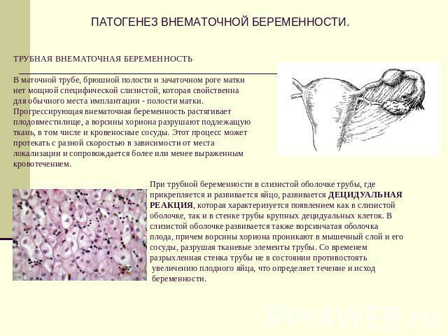 Pathogenesis of ectopic trudnoće