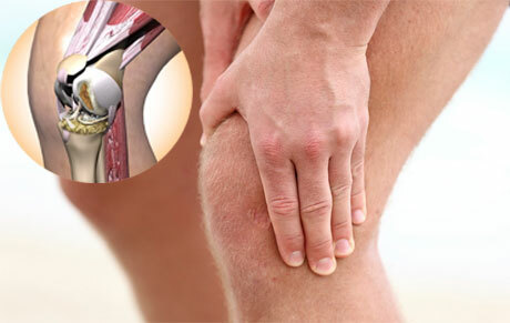 Simptomele artritei genunchiului