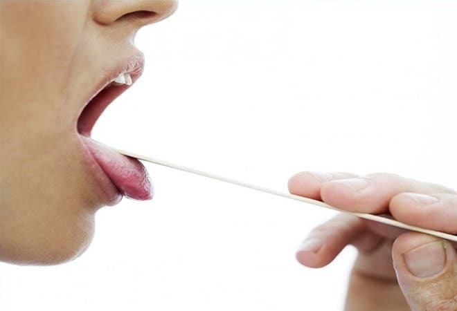 Idioma para gastrite: placa, um nó na garganta, mau hálito, boca seca