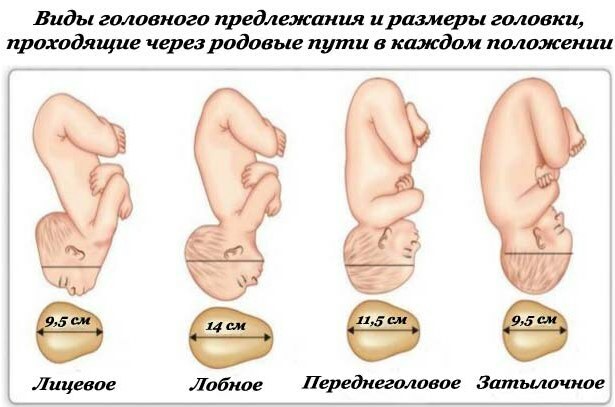 Cephalic presentation of the fetus at 20-30 weeks of gestation. What does it mean