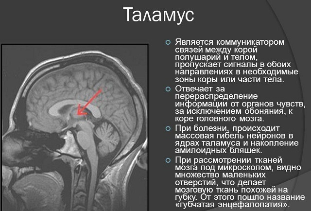 Violation of the thalamus