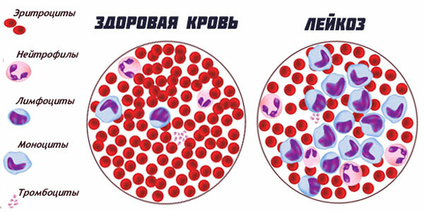 Atypical lymphocytes in the blood test in adults, children are lowered, increased. What does it mean, the norm