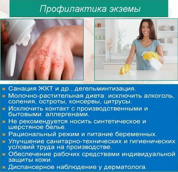 Dieta pentru eczeme pe mâini la adulți. Meniu pentru săptămână
