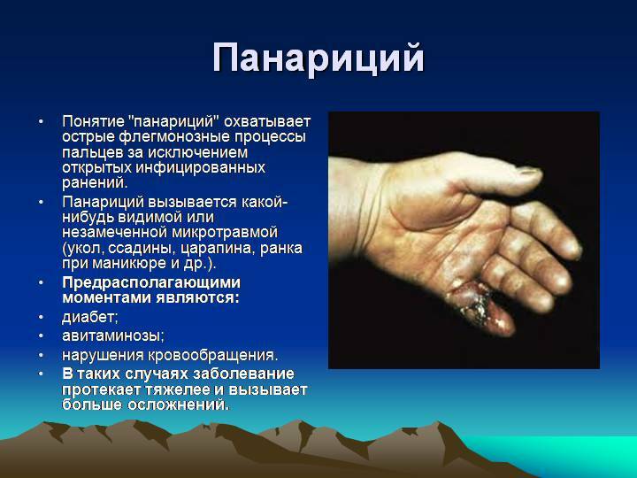 Panaritiumfinger på armen: behandling - de mest effektive behandlingsmetoder