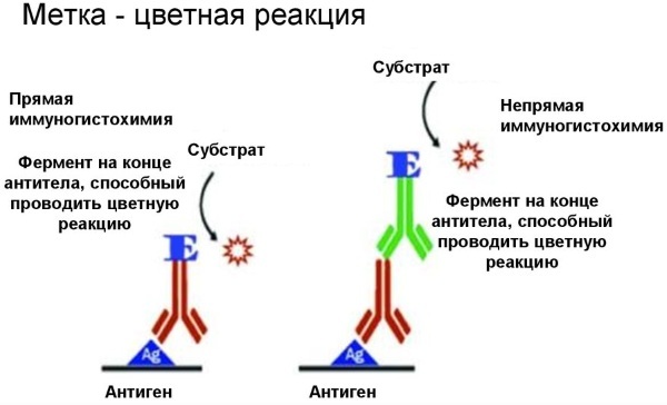 IHC research. What is it, how is it carried out, transcript