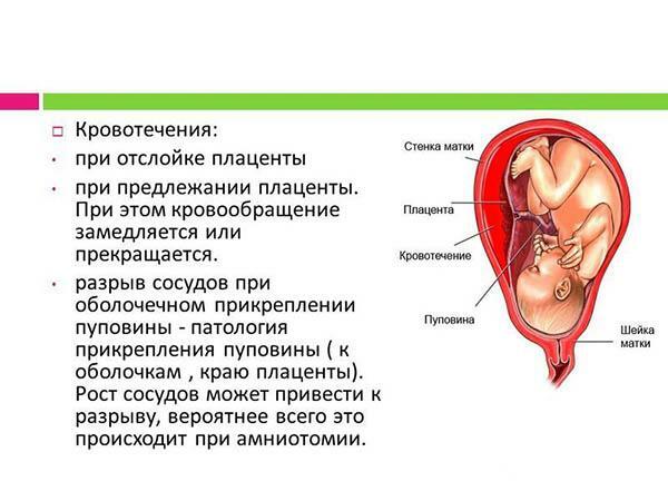 2 gruppi di cause di ipossia fetale