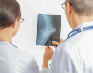 osteoartrite em raios-X